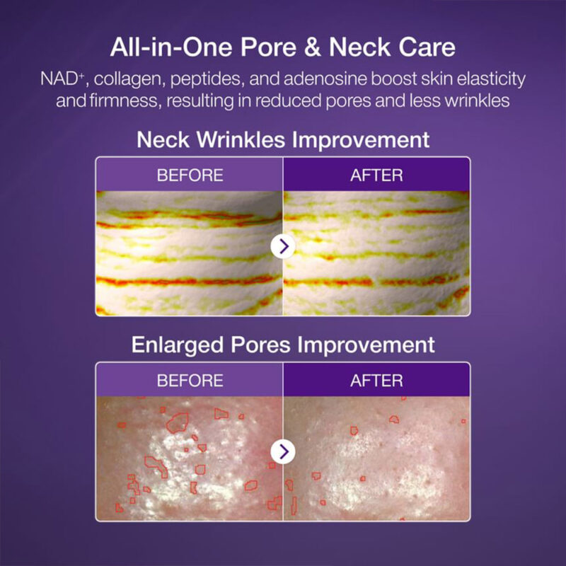 ماسک ضد چروک بایو لیفتینگ شماره 9 نامبوزین Numbuzin No.9 Sheet Mask NAD+ BIO Lifting-sil Full Face Mask - Image 9