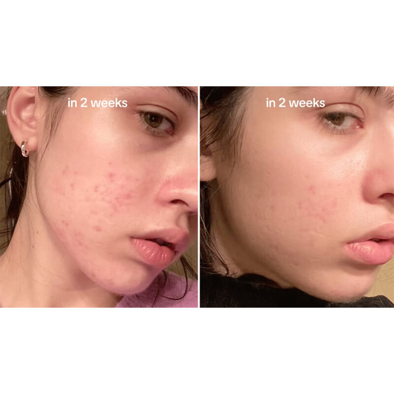 سرم ضد لک نیاسینامید و ترانگزامیک اسید آنوا Anua Niacinamide 10% + TXA 4% Dark Spot Correcting Serum - Image 3