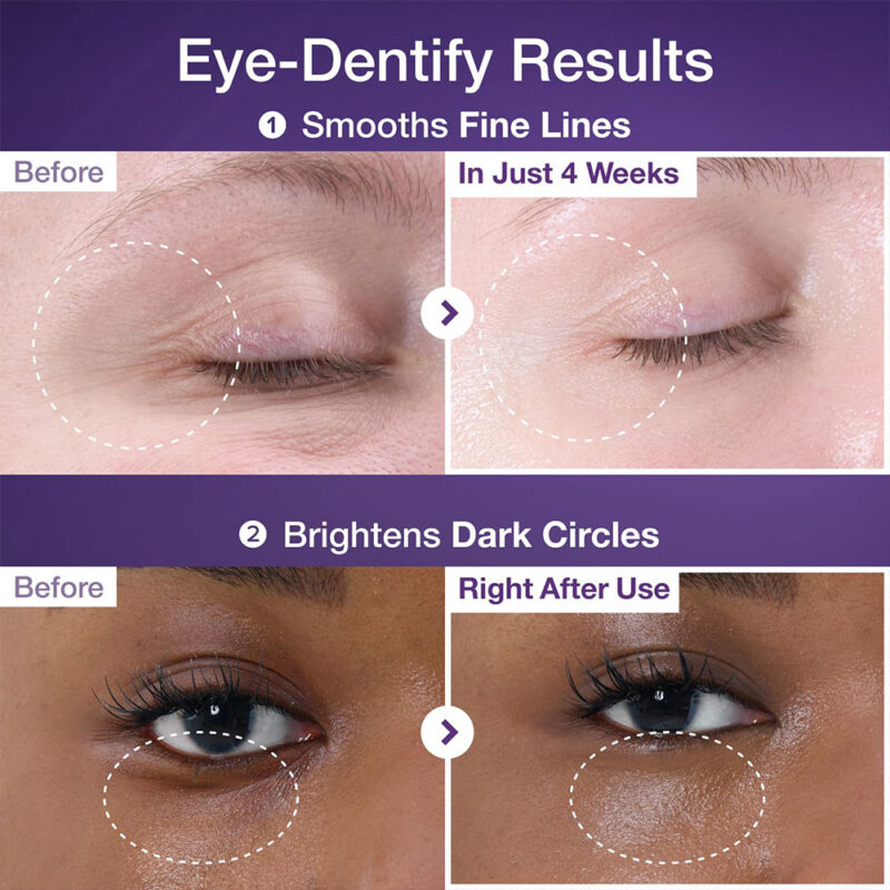 کرم دور چشم +NAD و رتینول شماره 9 نامبوزین ضد چروک و روشن کننده NUMBUZIN No.9 NAD+ Retinol Volumetox Eye Cream - Image 2