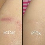 روغن ترمیم کننده پوست بایو اویل Bio Oil Skincare Body Oil حجم 200 میل - Image 5