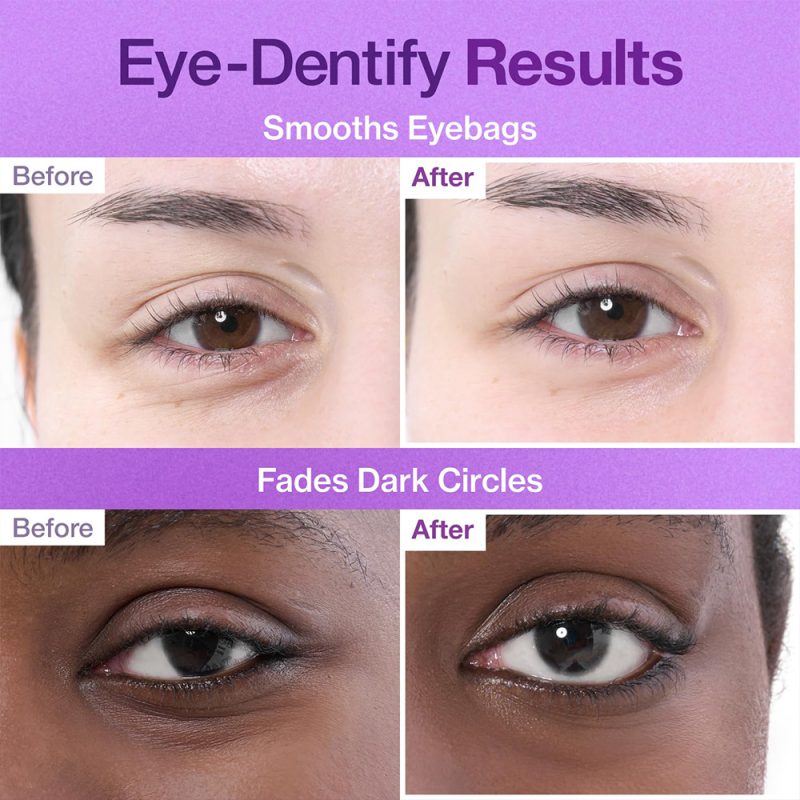 پچ زیر چشم جوانساز و ضد چروک نامبوزین شماره 9 - Image 2