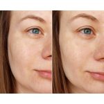 ژل شستشو و روشن کننده اسکین 1004 SKIN1004 Madagascar Centella Tone Brightening Cleansing Gel Foam حجم 125 میل - Image 5