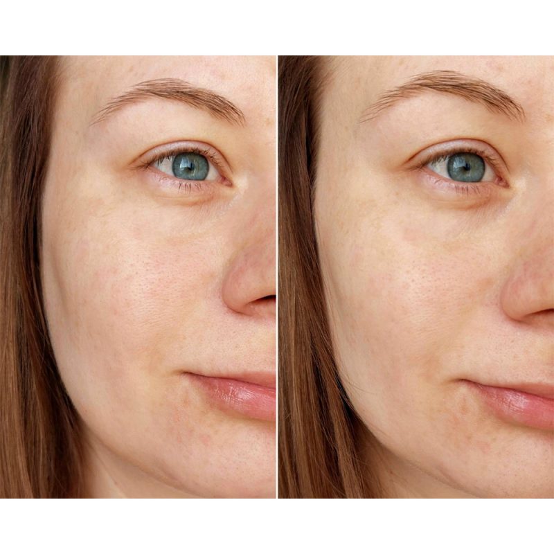 ژل شستشو و روشن کننده اسکین 1004 SKIN1004 Madagascar Centella Tone Brightening Cleansing Gel Foam حجم 125 میل - Image 5