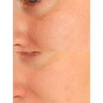 ژل شستشو و روشن کننده اسکین 1004 SKIN1004 Madagascar Centella Tone Brightening Cleansing Gel Foam حجم 125 میل - Image 6