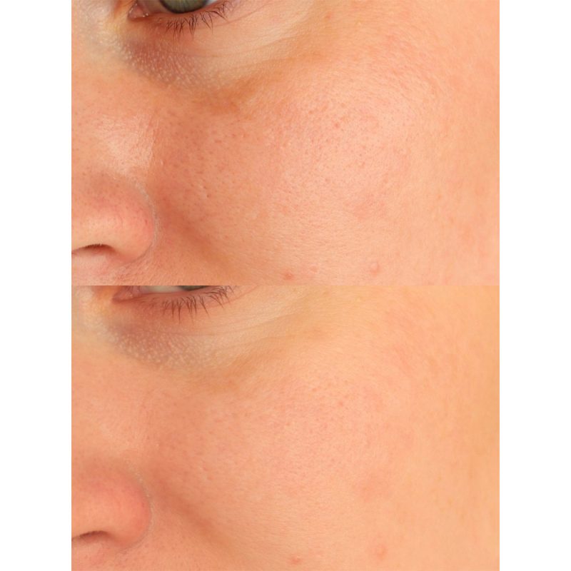 ژل شستشو و روشن کننده اسکین 1004 SKIN1004 Madagascar Centella Tone Brightening Cleansing Gel Foam حجم 125 میل - Image 6