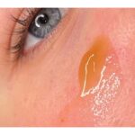کرم تسکین دهنده و ترمیم کننده سنتلا اسکین 1004 centella حجم 75 میل - Image 4