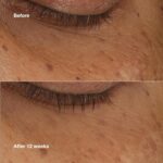 سرم دور چشم روشن کننده کلینیک CLINIQUE ALL ABOUT EYES حجم 10 میل - Image 6