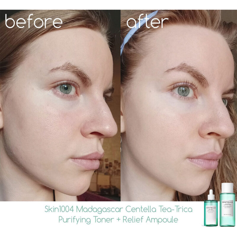 تونر ضد جوش اسکین 1004 - SKIN1004 Centella Tea-Trica حجم 210 میل - Image 7