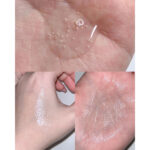 سرم روشن کننده و ضد لک سنتلا تون اسکین 1004 Skin1004 Centella حجم 100 میل - Image 4