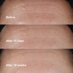سرم ضد چروک کلینیک CLINIQUE SMART CLINICAL REPAIR حجم 10 میل - Image 5