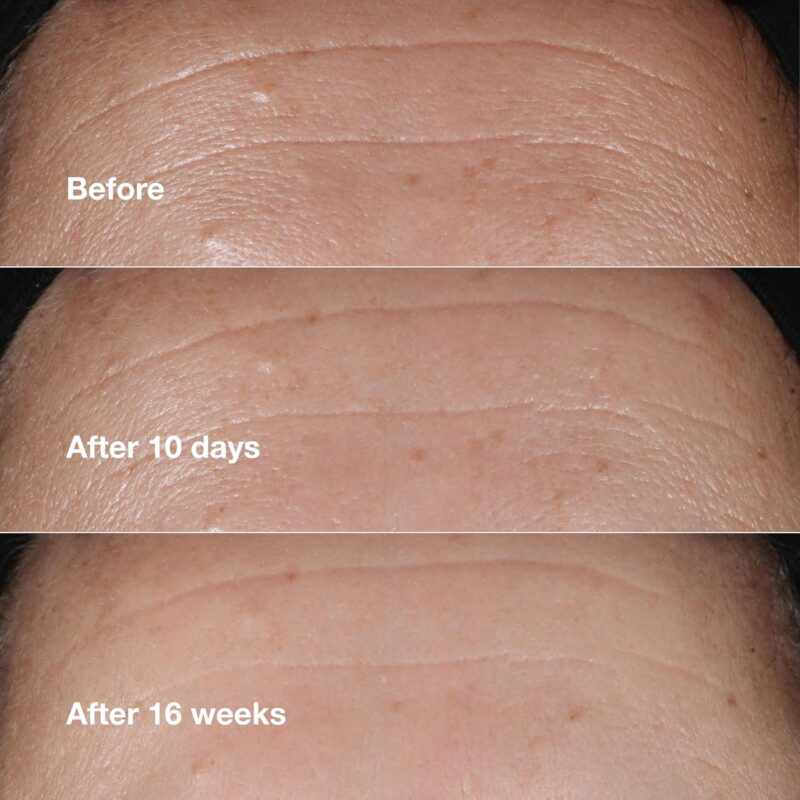 سرم ضد چروک کلینیک CLINIQUE SMART CLINICAL REPAIR حجم 10 میل - Image 5