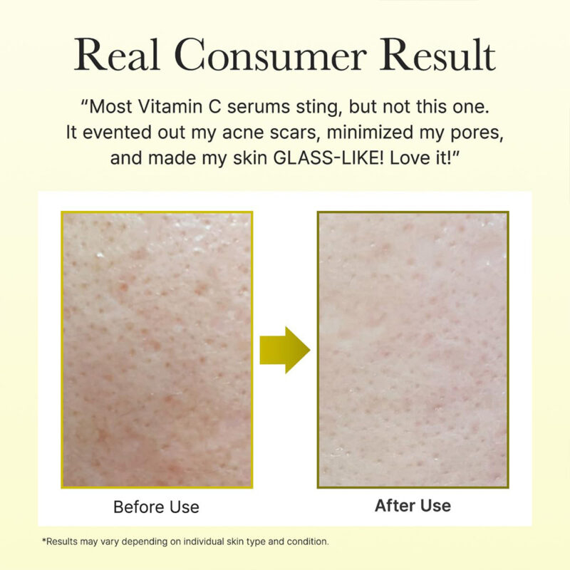 سرم دور چشم و صورت ویتامین سی آرنسیا Arencia VITAMIN C BOOSTER SHOT حجم 30 میل - Image 6