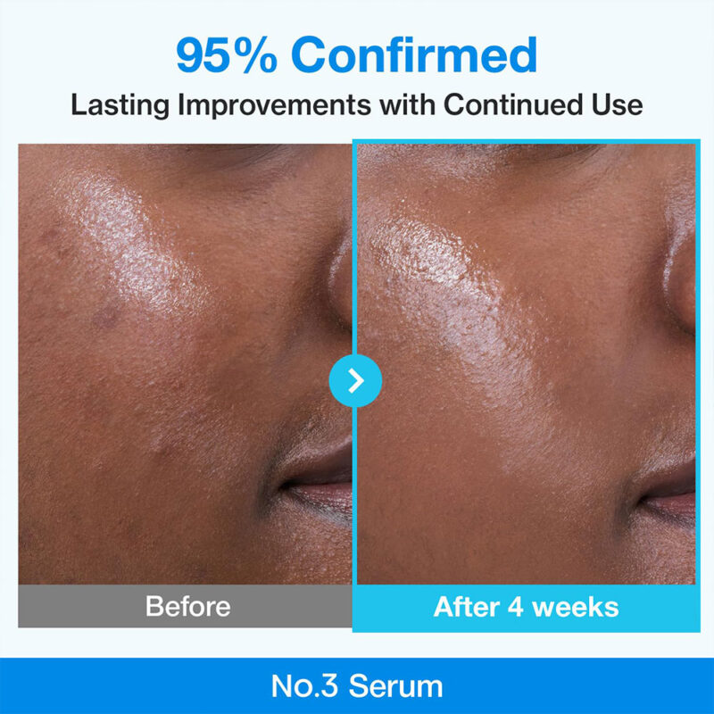 سرم کنترل منافذ بایو رتینول آبی و نیاسینامید نامبوزین Numbuzin Blue Bio-Retinol + Niacinamide حجم 30 میل - Image 4