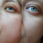 تونر لایه بردار و جوانساز سنتلا اسکین 1004 SKIN 1004 CENTELLA حجم 210 میل - Image 2