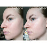 تونر لایه بردار و جوانساز سنتلا اسکین 1004 SKIN 1004 CENTELLA حجم 210 میل - Image 3