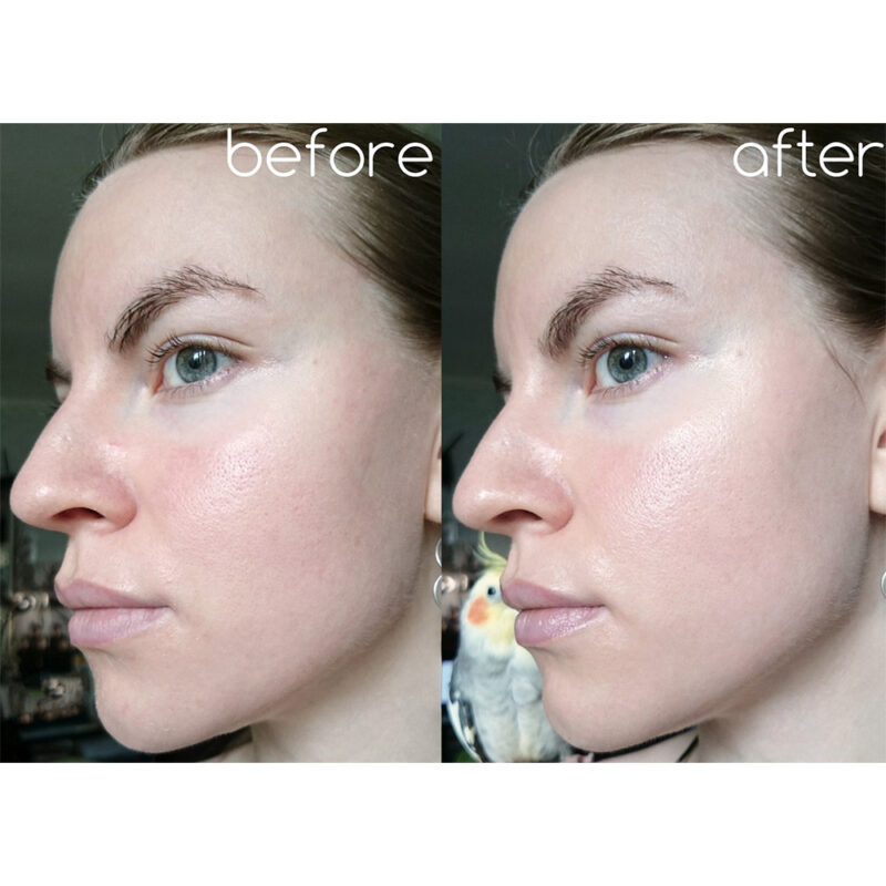 تونر لایه بردار و جوانساز سنتلا اسکین 1004 SKIN 1004 CENTELLA حجم 210 میل - Image 3