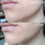 تونر لایه بردار و جوانساز سنتلا اسکین 1004 SKIN 1004 CENTELLA حجم 210 میل - Image 5