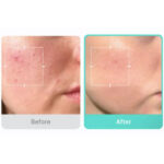 سرم ضد جوش و تسکین دهنده آزلائیک اسید مدی کیوب medicube AZELAIC ACID 16 حجم 30 میل - Image 2