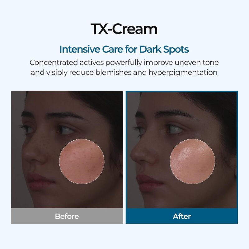 کرم ضد لک و روشن کننده دکتر ملاکسین Dr.Melaxin TX-Cream حاوی حاوی ترانگزامیک و نیاسینامید حجم 50 میل - Image 2