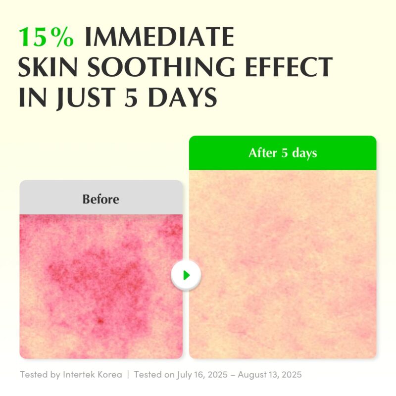 سرم PDRN و آلوئه ورا ترمیم کننده و تسکین دهنده قوی پوست اکوال بری EQQUALBERRY Aloe PDRN Calming Serum حجم 30 میل - Image 4