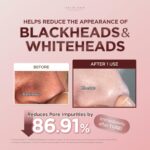 ماسک استیکی خاک رس کنترل منافذ سنتلا اسکین 1004 Skin 1004 Centella حجم 27 گرم - Image 9