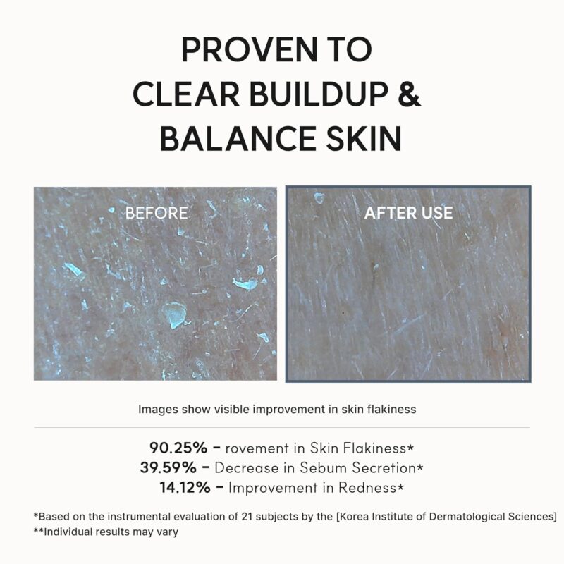 سرم لایه بردار و روشن کننده پوست آرنسیا Arencia eraser shot glycolic acid ضد منافذ باز حجم 30 میل - Image 7