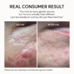 سرم لایه بردار و روشن کننده پوست آرنسیا Arencia eraser shot glycolic acid ضد منافذ باز حجم 30 میل - Image 9