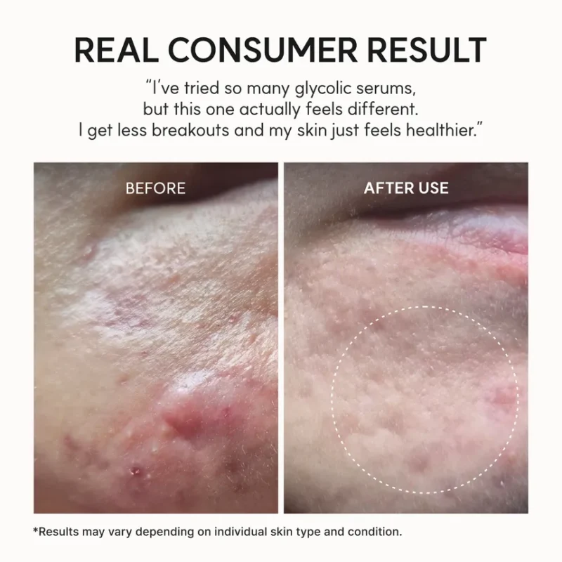 سرم لایه بردار و روشن کننده پوست آرنسیا Arencia eraser shot glycolic acid ضد منافذ باز حجم 30 میل - Image 9