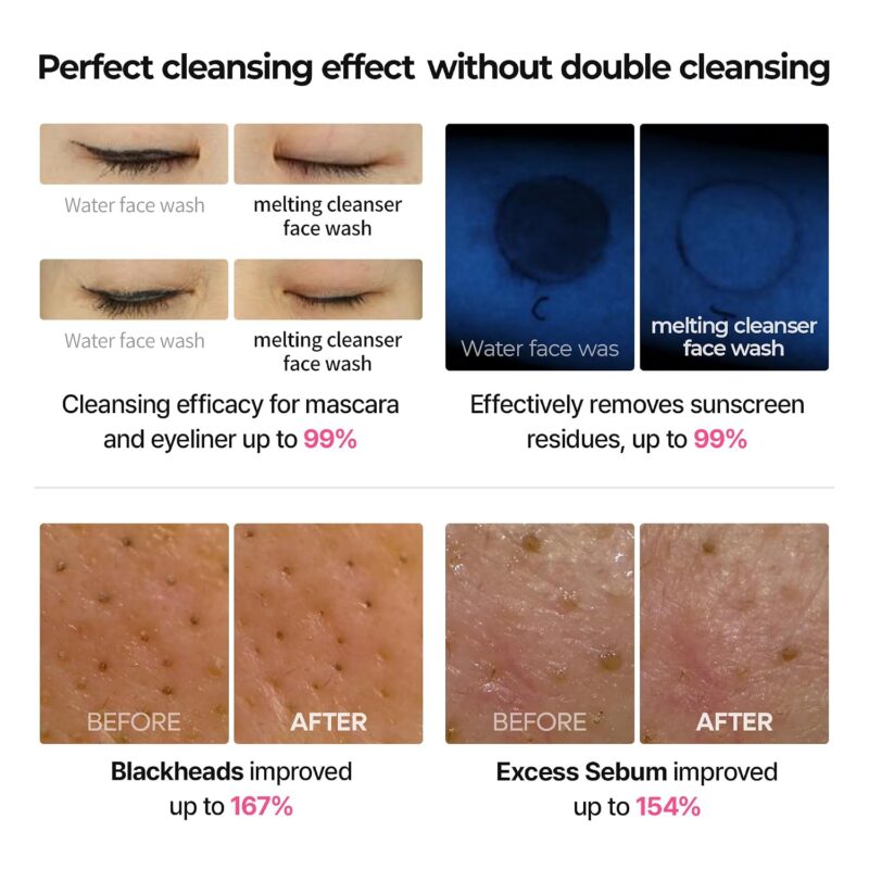 فوم شوینده و پاک‌کننده آرایش دکتر ملاکسین Dr. Melaxin Melting Bubble Foaming Cleanser حاوی کالامین و نیاسینامید حجم 150 میل - Image 7