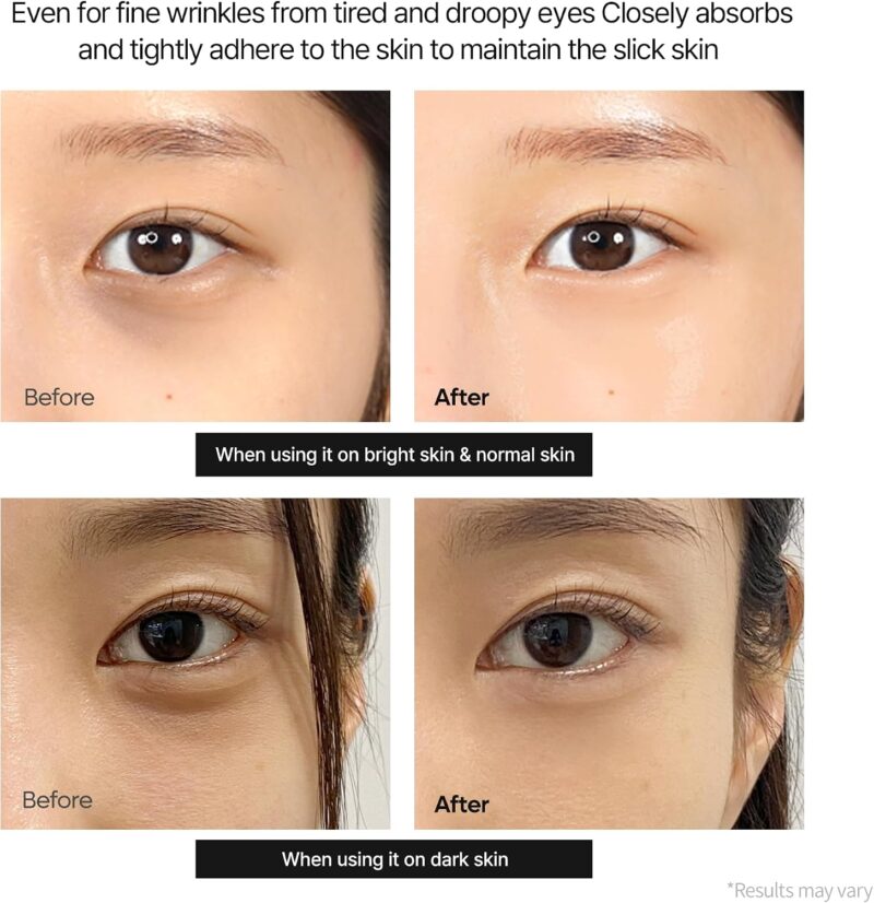 کرم دور چشم ضدلک کلسیم دکتر ملاکسین Dr. Melaxin Calcium Dark Spot Cover Eye Cream حجم 15 گرم - Image 6