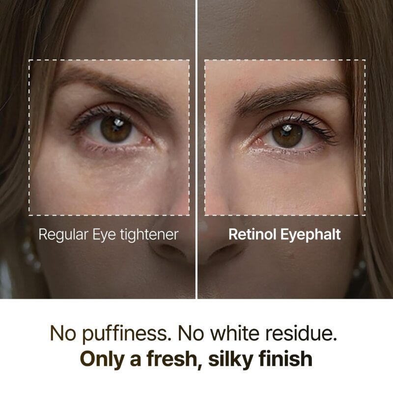 کرم دور چشم رتینول دکتر ملاکسین Dr.Melaxin Eyephalt Retinol Eyebag مناسب پف، تیرگی و خطوط ریز دور چشم حجم 10 گرم - Image 4