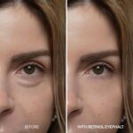 کرم دور چشم رتینول دکتر ملاکسین Dr.Melaxin Eyephalt Retinol Eyebag مناسب پف، تیرگی و خطوط ریز دور چشم حجم 10 گرم - Image 5