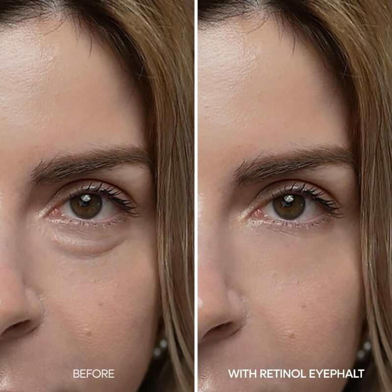 کرم دور چشم رتینول دکتر ملاکسین Dr.Melaxin Eyephalt Retinol Eyebag مناسب پف، تیرگی و خطوط ریز دور چشم حجم 10 گرم - Image 5