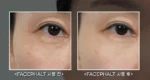 کرم ضد چروک و لیفتینگ صورت دکتر ملاکسین Dr. Melaxin Facephalt حجم 50 گرم - Image 13