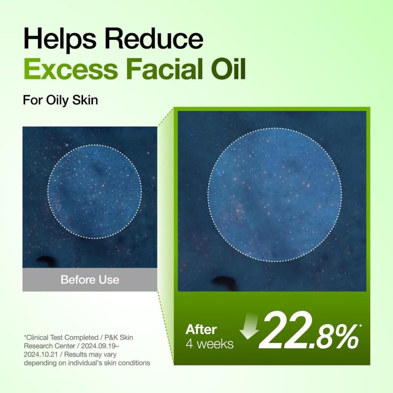 سرم آبرسان ضدجوش و  ضدقرمزی آنوا Anua Azelaic Acid 10 Hyaluron Redness Soothing Serum Kpop Demon Hunters حجم 50 میل - Image 14