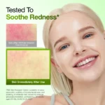سرم آبرسان ضدجوش و  ضدقرمزی آنوا Anua Azelaic Acid 10 Hyaluron Redness Soothing Serum Kpop Demon Hunters حجم 50 میل - Image 7