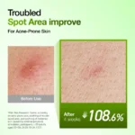 سرم آبرسان ضدجوش و  ضدقرمزی آنوا Anua Azelaic Acid 10 Hyaluron Redness Soothing Serum Kpop Demon Hunters حجم 50 میل - Image 8