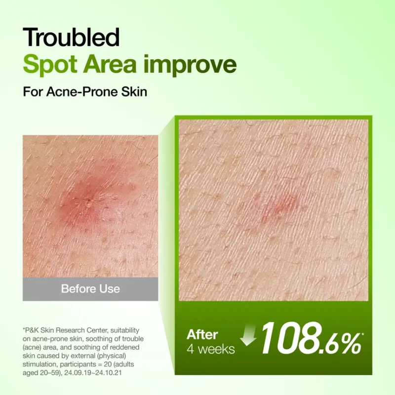 سرم آبرسان ضدجوش و  ضدقرمزی آنوا Anua Azelaic Acid 10 Hyaluron Redness Soothing Serum Kpop Demon Hunters حجم 50 میل - Image 8