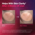 سرم ضدلک و یکنواخت‌کننده رنگ پوست آنوا Anua Niacinamide 10 TXA 4 Serum Kpop Demon Hunters حاوی نیاسینامید و ترانگزامیک اسید حجم 50 میل - Image 5