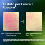 سرم آبرسان ضدجوش و  ضدقرمزی آنوا Anua Azelaic Acid 10 Hyaluron Redness Soothing Serum Kpop Demon Hunters حجم 50 میل - Image 5