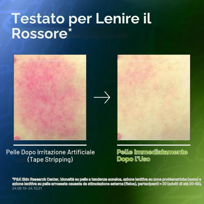 سرم آبرسان ضدجوش و  ضدقرمزی آنوا Anua Azelaic Acid 10 Hyaluron Redness Soothing Serum Kpop Demon Hunters حجم 50 میل - Image 5
