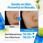 فوم شوینده صورت ضدجوش و پاک‌کننده منافذ نامبوزین Numbuzin Zero Blemish Clarifying حاوی 2٪ گوگرد، سالیسیلیک اسید و PHA حجم 150 میل - Image 4