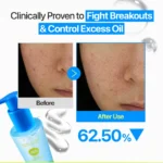 ژل میسلار پاک‌کننده صورت بدون چربی نامبوزین Numbuzin Zero Blemish مناسب پوست مستعد جوش حجم 200 میل - Image 4