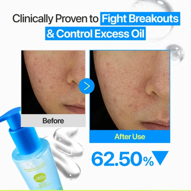 ژل میسلار پاک‌کننده صورت بدون چربی نامبوزین Numbuzin Zero Blemish مناسب پوست مستعد جوش حجم 200 میل - Image 4